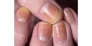 nail care tips achieving healthy and