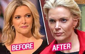 megyn kelly shows off new cut after
