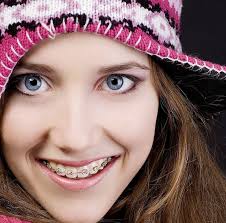 We've been straightening smiles for over 15 years and are part of bupa, so you can rely on us to provide quality dental care and excellent customer service. Http Www Aboutbraces Com Au Orthodontic Braces Type A Total Tooth Moving System Which Can Result In Amazing Adjustments To Braces Girls Braces Orthodontics