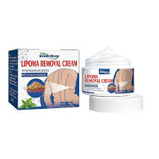 lipoma removal cream lipolysis fat lump