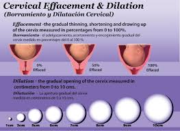 Cervical Dilation Effacement Station Chart