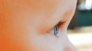 9 rare eye conditions marano eye care
