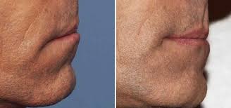 plastic surgery case study male