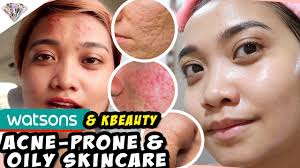 effective na anti acne oily skin care