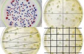 how to count colonies on agar plates a