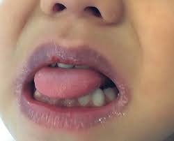 ed lips and strawberry tongue