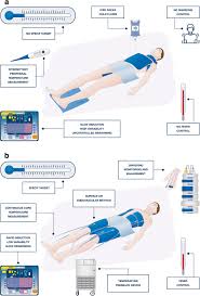 after cardiac arrest