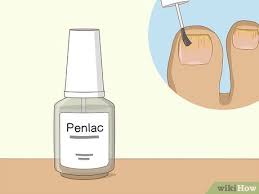 how to cure toenail fungus can vinegar
