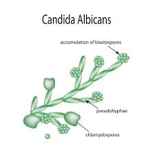 candidiasis guide causes symptoms and