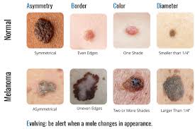 skin cancer dermatology plastic