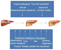 Nonalcoholic Fatty Liver Disease Evolving Paradigms