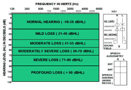Hearing Losses And Audiograms A Guide For Parents With