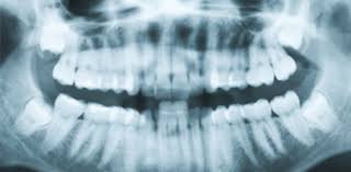what is a dental cone beam image