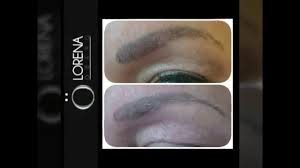 permanent makeup removal microblading