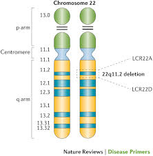 22q11 2 Deletion Syndrome Nature Reviews Disease Primers