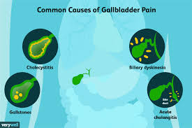 what causes gallbladder pain