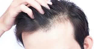 B vitamins help with hair growth because they play a key role in producing red blood cells, which carry oxygen to the scalp so that hair follicles can generate new hair. Vitamin D Deficiency Hair Loss Symptoms And Treatment