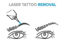 microblading removal lexington tattoo