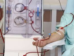 Dialysis Procedure Purpose Types Side Effects And More