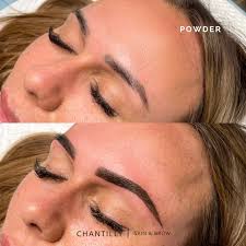 cosmetic tattooing chantilly skin clinic