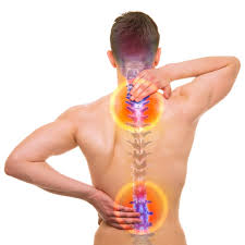 untreated spinal stenosis risks