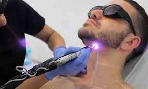 Overall, laser hair removal is a relatively quick process. Laser Hair Removal Benefits Risks For Men