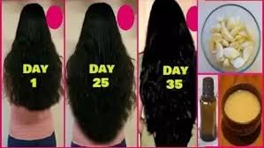 How much does hair grow in a year? Baby Hair Growth Panosundaki Pin