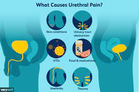 urethral pain causes treatment when