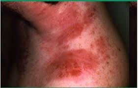 what is dermais contour dermatology