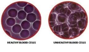 Live And Dry Blood Cell Analysis In Etobicoke Better Living