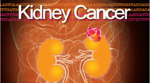 bladder cancer journal vol 4 issue 2