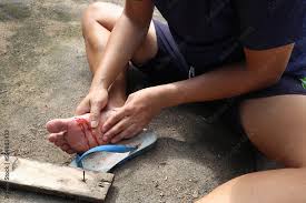 an asian man shows a foot wound after