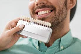 How Much Do Dental Veneers Cost? - Atlanta Smiles