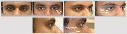 what is eye shape change dr taban md