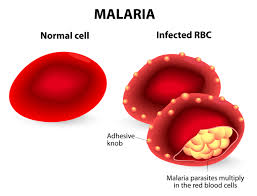 Malaria Symptoms Diagnosis Prevention And Diet Plan