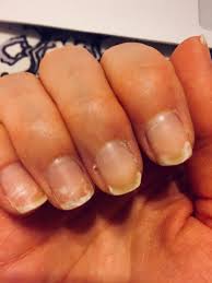 what your nails are dying to tell you
