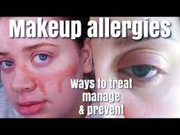 heal allergic reactions to makeup on