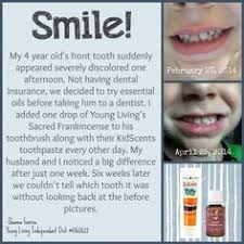 Young Living Essential Oils Toothpaste Comparison Chart
