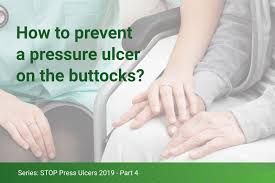 prevent pressure ulcers on the ocks