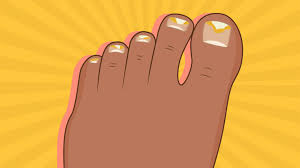 toenail fungal infections