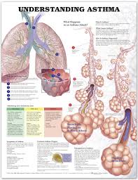 Understanding Asthma Anatomical Chart Laminated