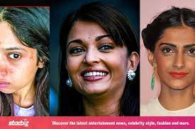 5 bollywood actresses with bad skin