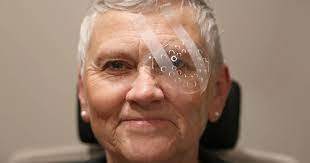 Laser cataract surgery is an outpatient surgical procedure in which a you can wear anything comfortable to your surgery appointment. Cataract Surgery Recovery Tips Recovery Time All About Vision