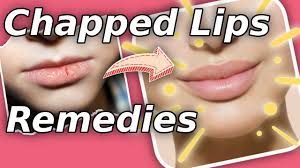 chapped ed lips home remes