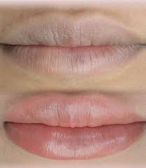 blue lips cyanosis there is a solution
