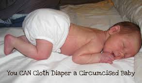 Bathing baby after circumcision it's totally fine to bathe your baby following circumcision. How To Use Cloth Diapers On A Circumcised Baby Padded Tush Stats