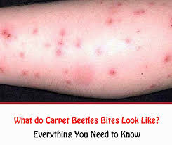 what do carpet beetles bites look like