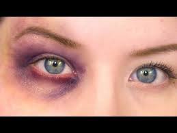 realistic bruised eye makeup halloween