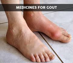 Mice injected with 0.5 or 1.0 mg/kg ip on day 6, 7 or 8, produced a low but significant increase in defective fetuses. List Of 21 Best Medicines For Gout Composition Dosage Popularity More 2021