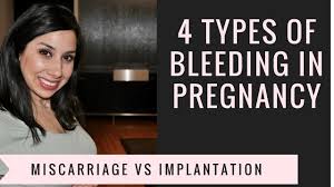 implantation bleeding what is it when
